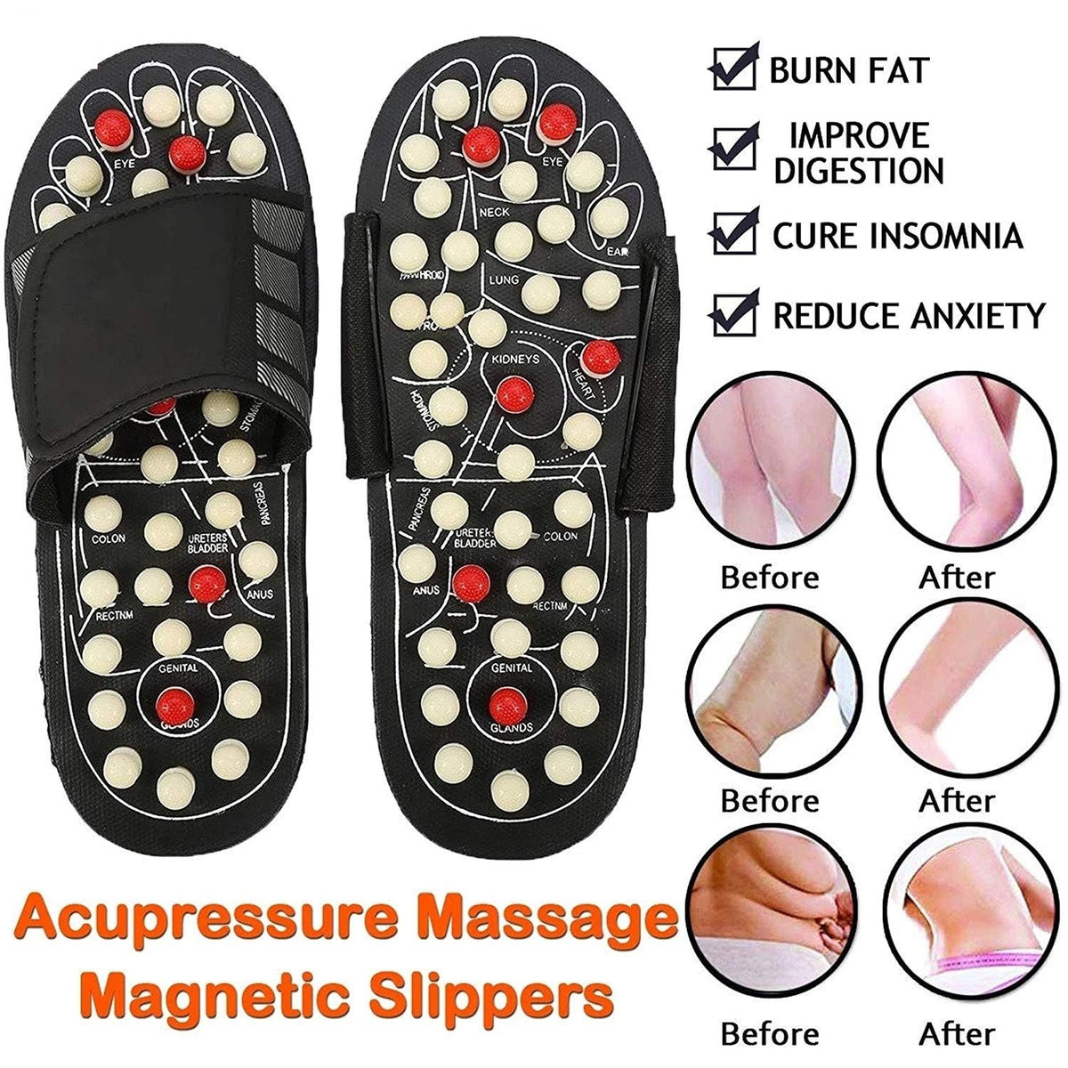 🔥FLAT 50% LEADÁS🔥Acupresszúra és mágneses terápiás papucsok